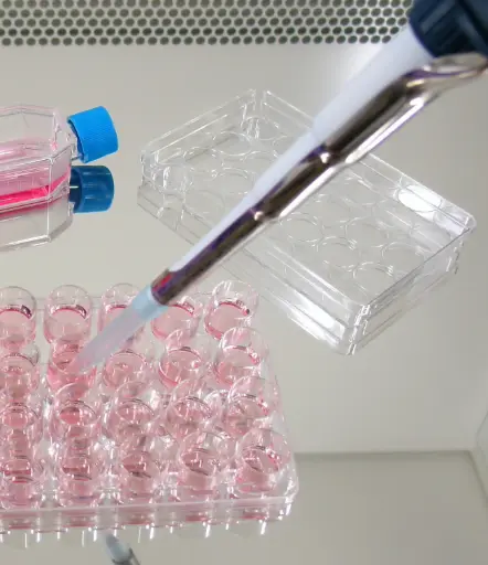 [MO-T40015E] mAb anti- human carbohydrate antigen 19-9 (CA 19-9) ,9E1