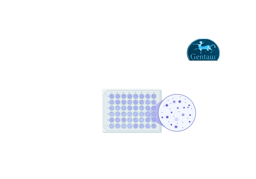 [WS-​1696] SARS-CoV-2 IGRA - INF-Gamma